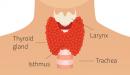 صورة مقال ما هي الغدة الدرقية