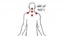 صورة مقال فوائد الحجامة في الرقبة