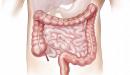 صورة مقال التهاب الأمعاء