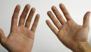 صورة مقال ما أسباب رعشة اليد