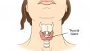 صورة مقال ما هو TSH