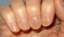 صورة مقال تغير لون الأظافر