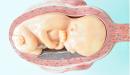 صورة مقال كيف يكون شكل الجنين في الشهر السابع