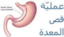 صورة مقال أضرار عملية قص المعدة