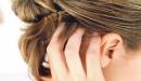 صورة مقال أسباب حكة فروة الرأس