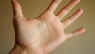 صورة مقال تنميل اليد اليمنى