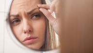 صورة مقال أسباب تساقط الحواجب