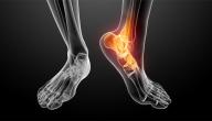 صورة مقال أسباب آلام المفاصل والعظام
