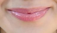 صورة مقال إزالة السواد من الشفاه