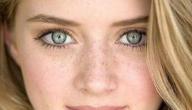 صورة مقال كيفية إزالة النمش من الوجه