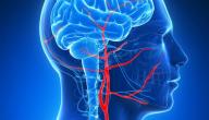 صورة مقال ارتفاع ضغط الدماغ