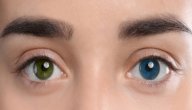 صورة مقال تغير لون العين