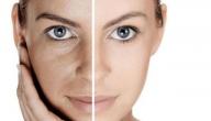صورة مقال وصفة مجربة لإزالة الكلف من الوجه