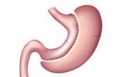 طرق تصغير المعدة