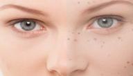 صورة مقال وصفة فعالة لإزالة البقع السوداء من الوجه