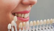 صورة مقال أنواع تبييض الأسنان - فيديو