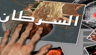 صورة مقال تفسير مرض السرطان في الحلم