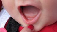 صورة مقال متى يبدأ ظهور الأسنان لدى الأطفال