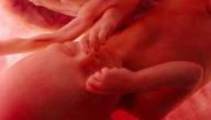 صورة مقال التفاف الحبل السري حول رقبة الجنين - فيديو