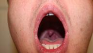 صورة مقال التهاب البلعوم