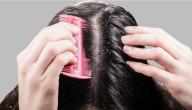 صورة مقال أنواع قشرة الشعر
