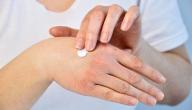 صورة مقال أفضل علاج لحساسية اليدين