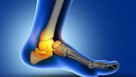 صورة مقال أعراض آلام كعب القدم
