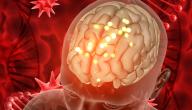 صورة مقال أسباب سرطان الدماغ