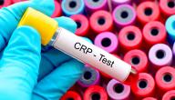 صورة مقال ما هو تحليل الدم crp