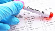 صورة مقال ما هو تحليل الكولسترول