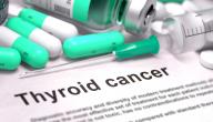 صورة مقال كيفية علاج سرطان الغدة الدرقية