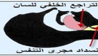 صورة مقال كيف يتم بلع اللسان