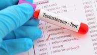 صورة مقال كيفية معرفة نسبة هرمون التستوستيرون