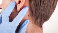 صورة مقال كيفية التخلص من الثآليل في الرقبة