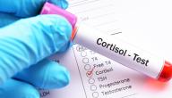 صورة مقال ما هو تحليل الكورتيزول