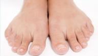 صورة مقال ما أسباب برودة القدمين