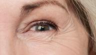 صورة مقال كيفية إزالة التجاعيد تحت العين