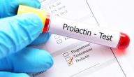 صورة مقال ما هو تحليل Prolactin