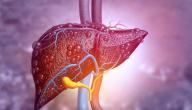 صورة مقال ما هو سبب ارتفاع إنزيمات الكبد