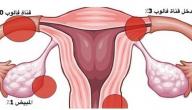 صورة مقال ما هي أسباب انسداد قناة فالوب
