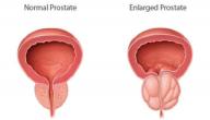 ما هو مرض البروستات