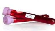 صورة مقال ماذا يعني فحص PSA