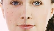 صورة مقال طريقة تصفية الوجه