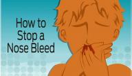 صورة مقال كيف أوقف النزيف