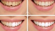 صورة مقال كيف أبيض أسناني