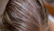صورة مقال كيفية علاج الشعر الخفيف