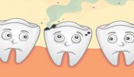 صورة مقال كيف أزيل تسوس الأسنان