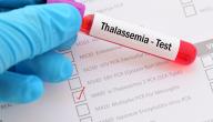 صورة مقال الثلاسيميا وفحوصات ما قبل الزواج