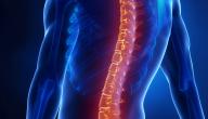 صورة مقال تشوهات العمود الفقري