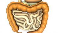 صورة مقال أعراض مرض القولون